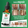 Professional Nail Repair Serum (Buy 1 Get 1)